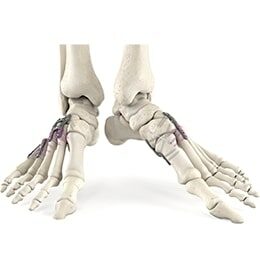 Midfoot Rollover (2)
